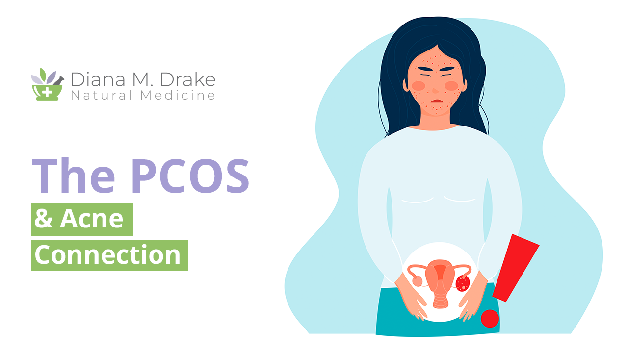 
The PCOS & Acne Connection